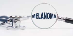 Melanoma Life Insurance
